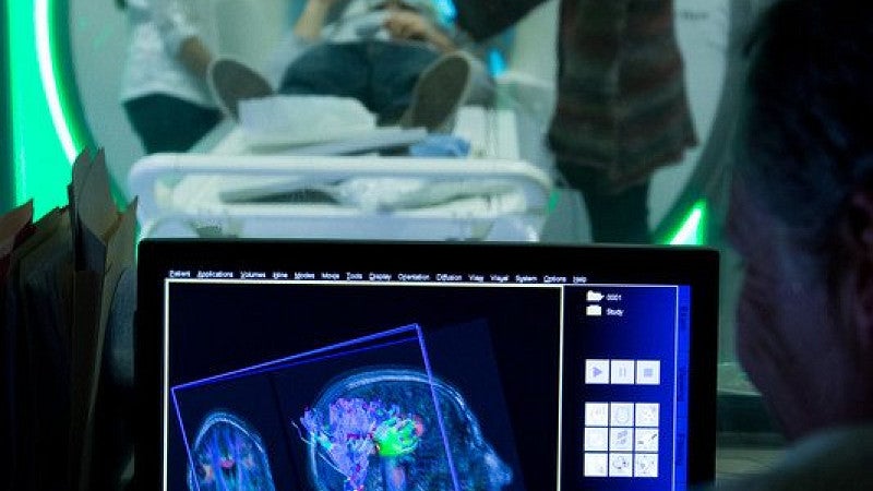 Image of brain on computer screen with MRI happening in background