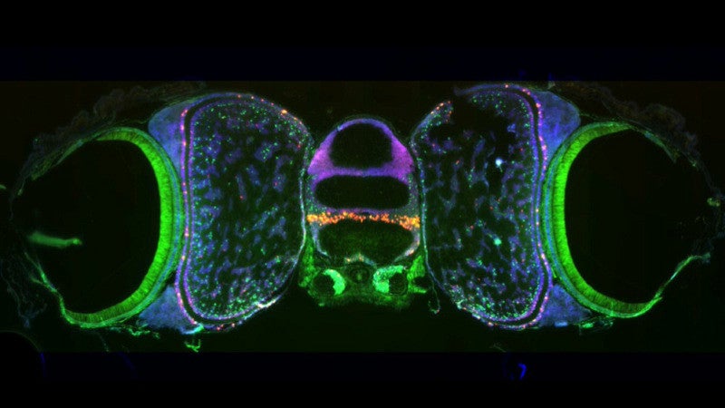 A fluorescent microscope image shows the octopus' optical lobe, the part of the brain that handles vision.