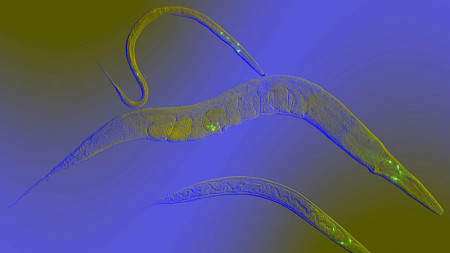 Depiction of sperm worms